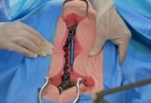 what is the average cost of spinal surgery uk