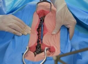 what is the average cost of spinal surgery uk