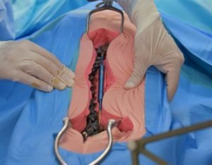 what is the average cost of spinal surgery uk