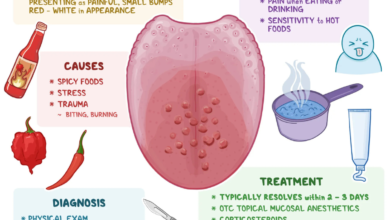 lie bumps on tongue