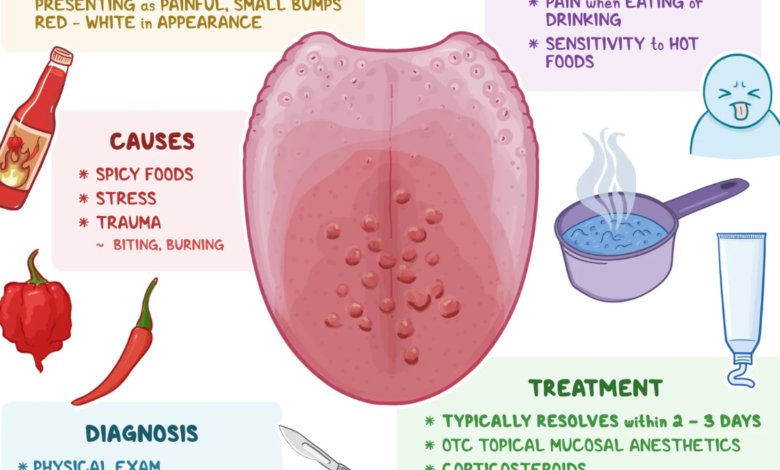 lie bumps on tongue