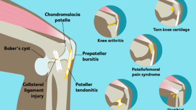 why does my knee hurt when i bend it