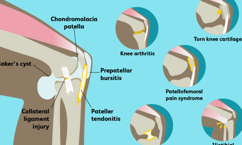 why does my knee hurt when i bend it
